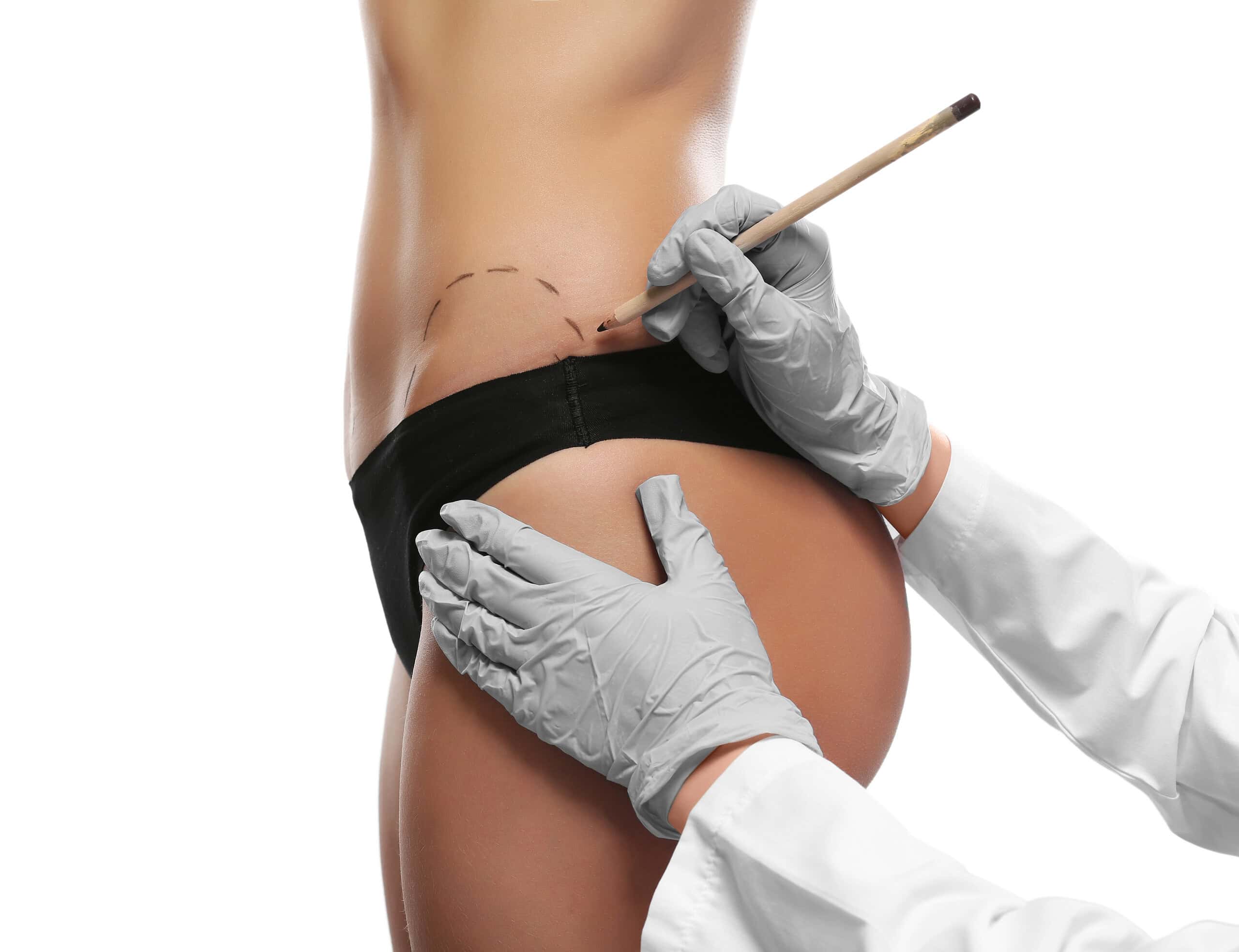 Body Surgery