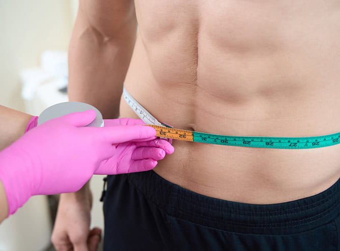 Male tummy tuck in Albania