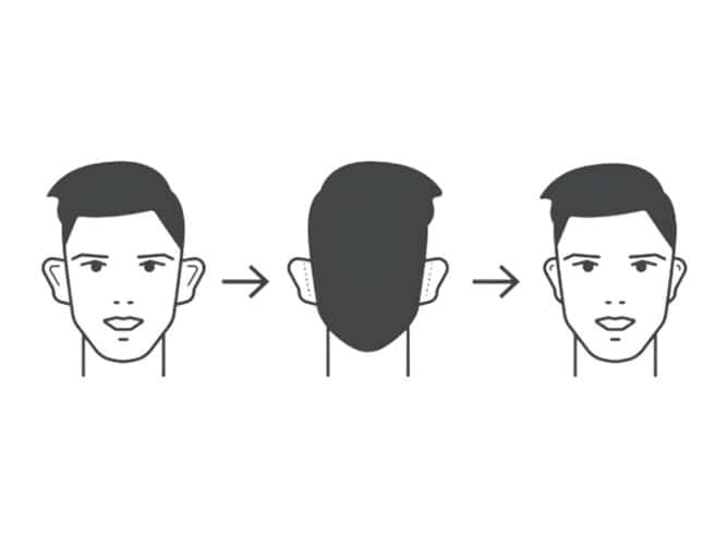 Ear surgery for men Albania