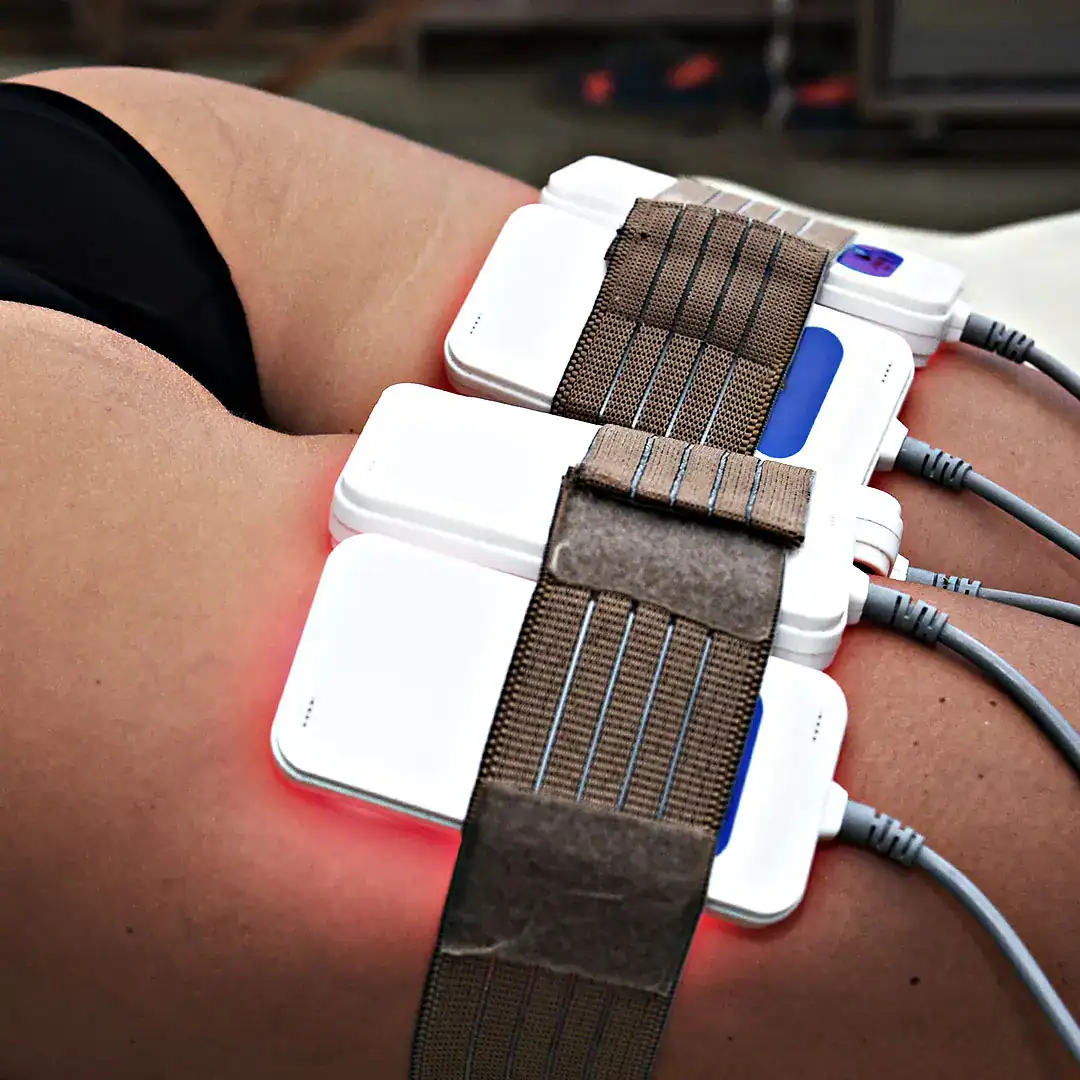 Non Invasive Liposuction working on woman thighs