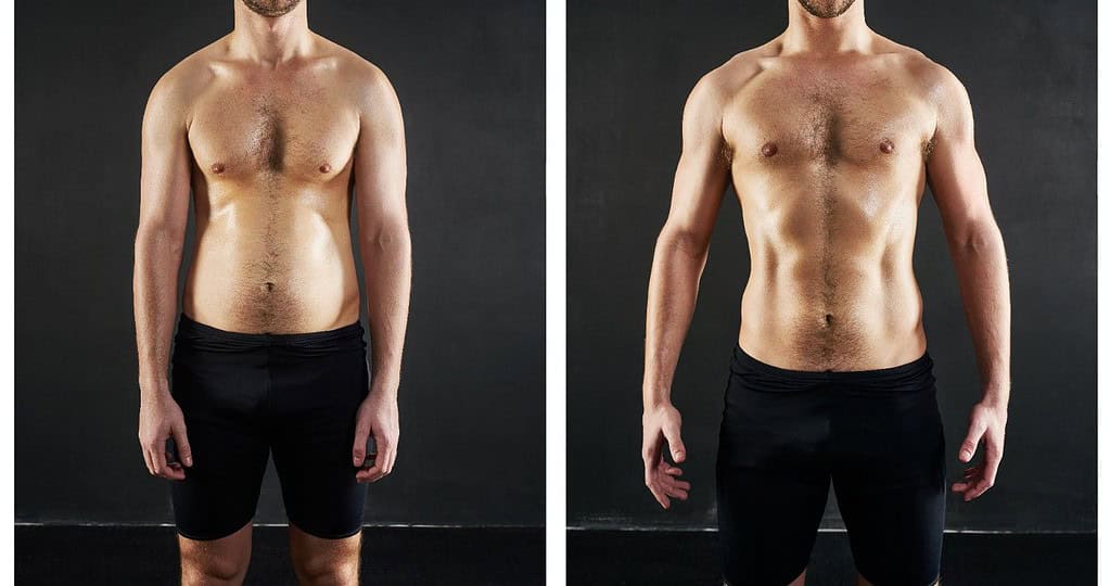 Affordable tummy tuck for men in Albania