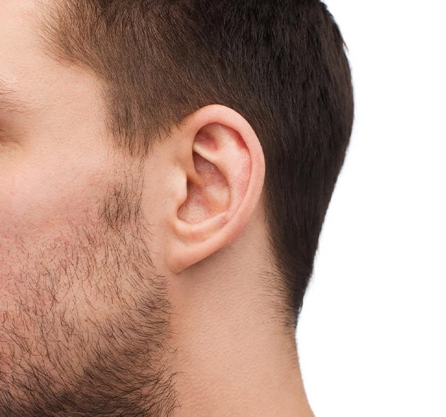 Otoplasty for men in Albania